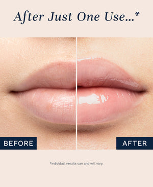 City Lips® Plumping Lip Gloss 플럼핑 립글로스 0.16oz (4.9ml)
